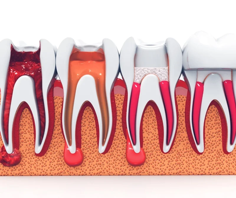 Cleanest City of India